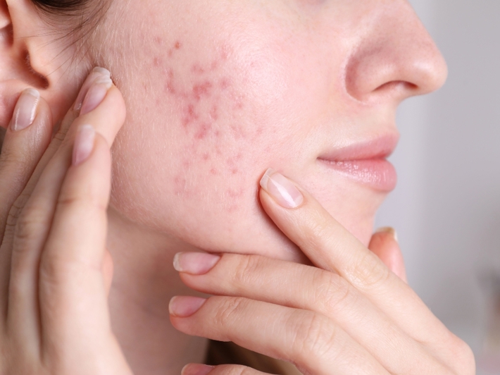 Best Skin Clinic in Coimbarore